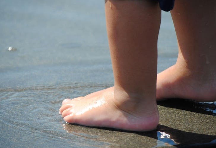 Niña sufre infección por pulgas en los pies, tras caminar descalza